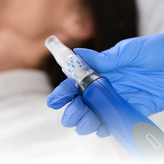 Microneedling Image